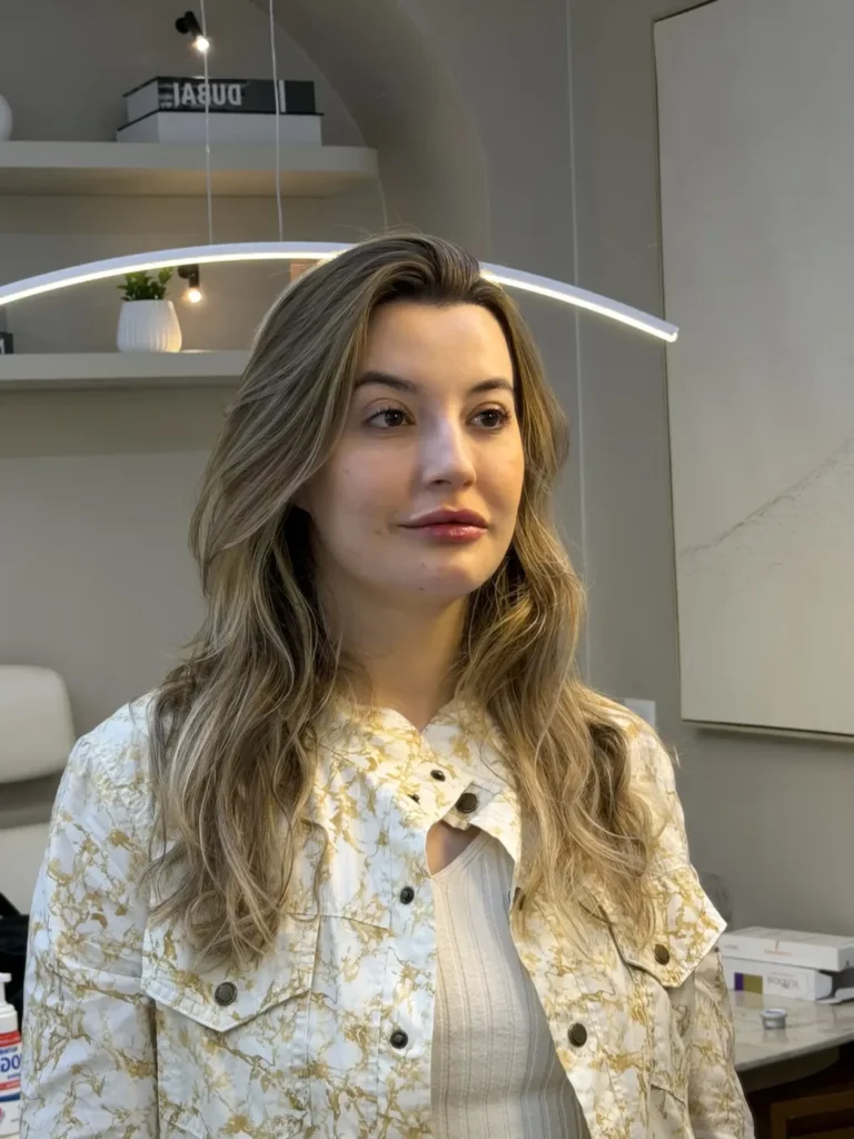 Paciente após harmonização facial full face