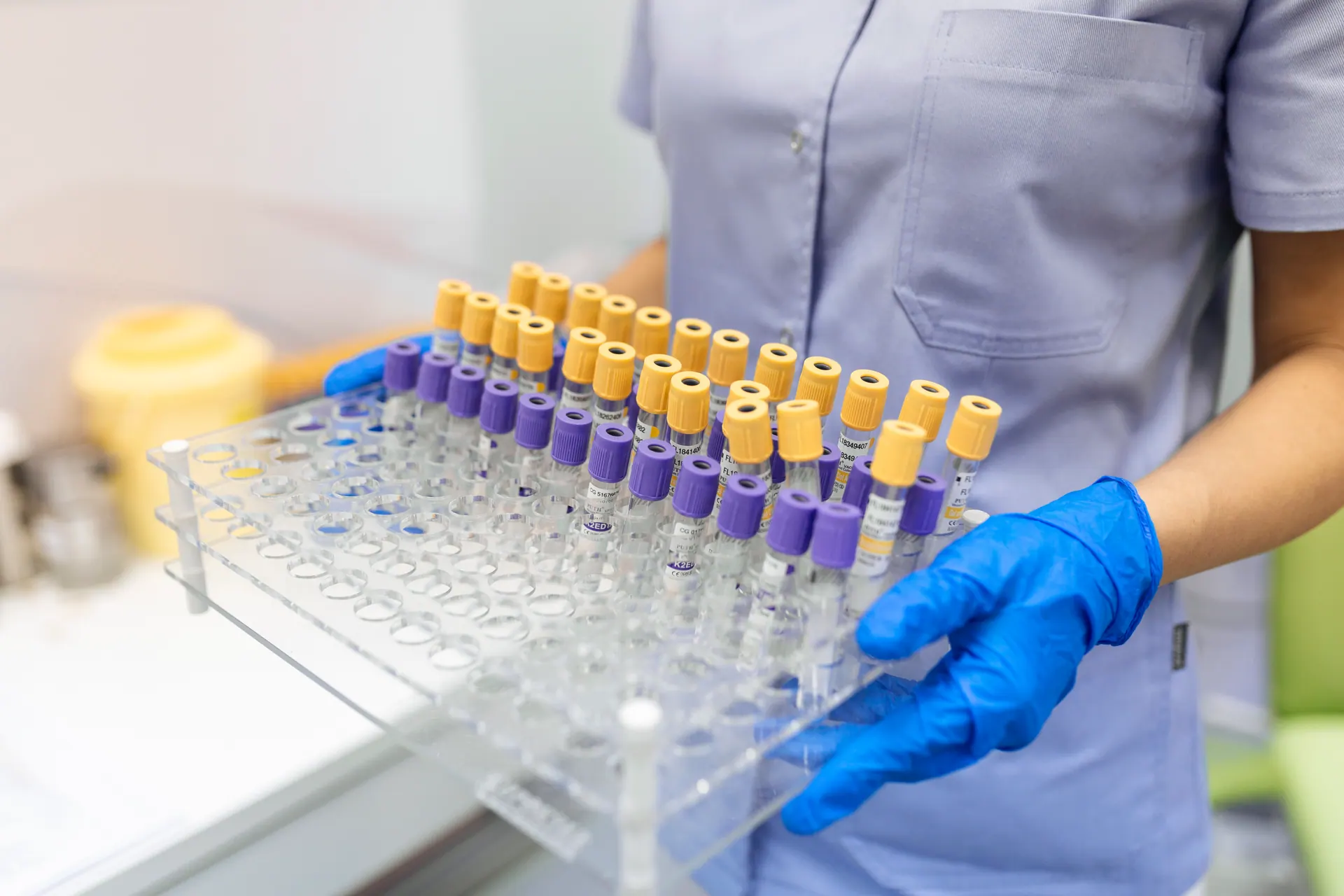 Estante com tubos de coleta identificados em laboratório clínico